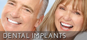 dental implant century City