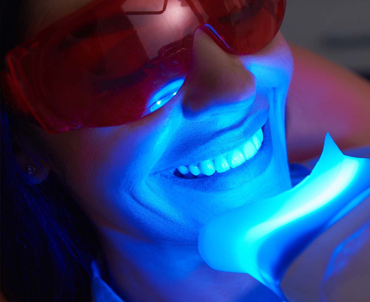 Teeth Whitening